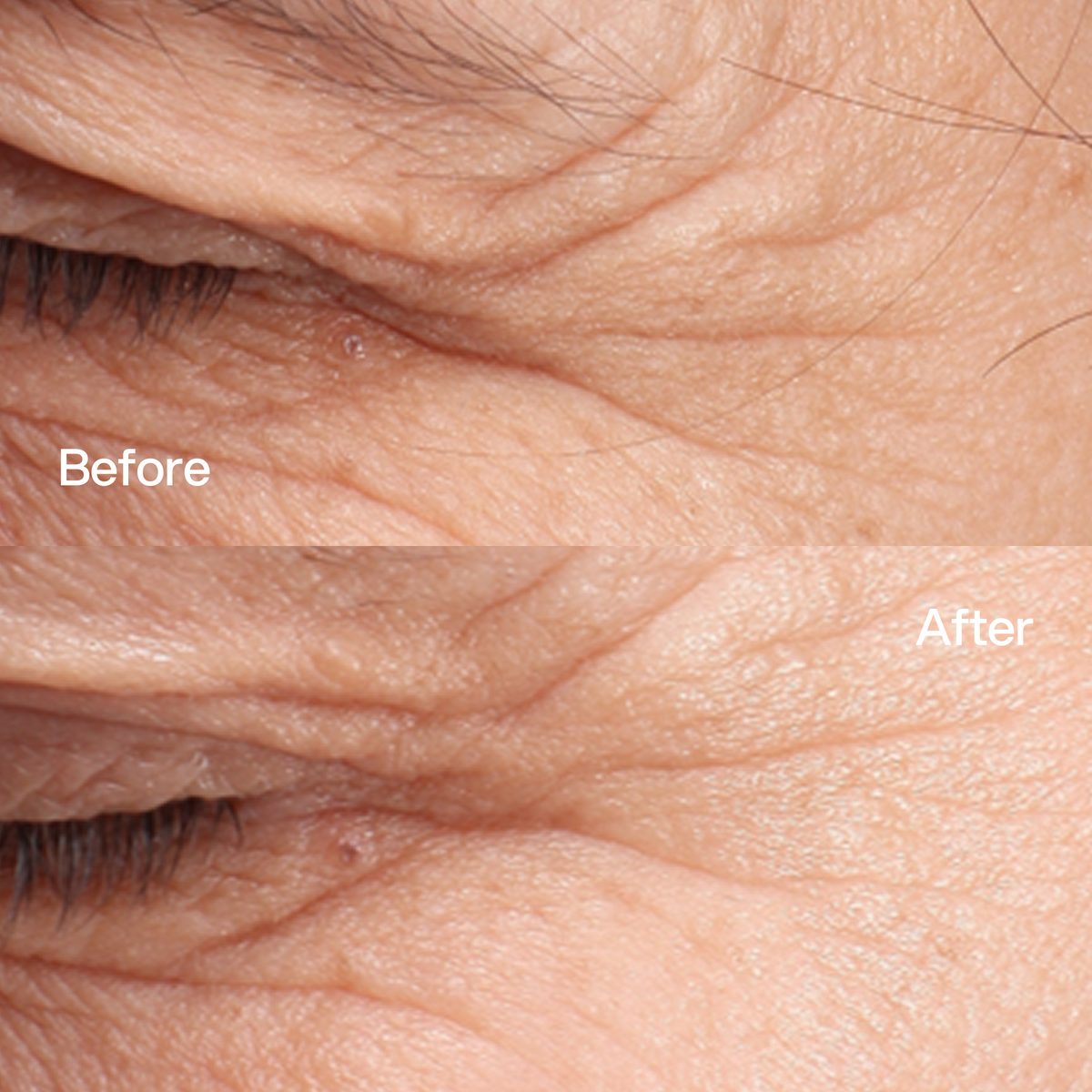 Booster Peptidi Skin First, risultati prima e dopo
