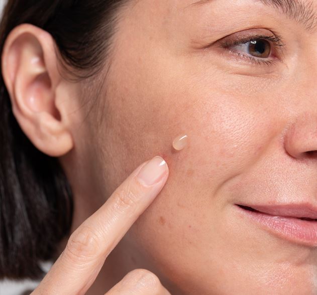 Macchie solari: cosa sono e come eliminarle dal viso