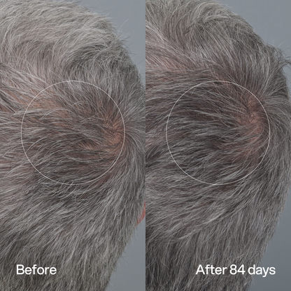 Hair Density Peptide Serum