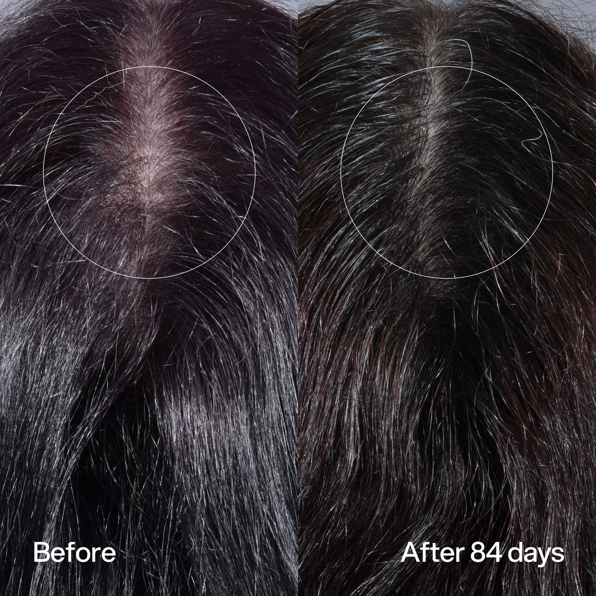 Hair Density Peptide Serum
