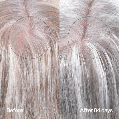 Hair Density Peptide Serum