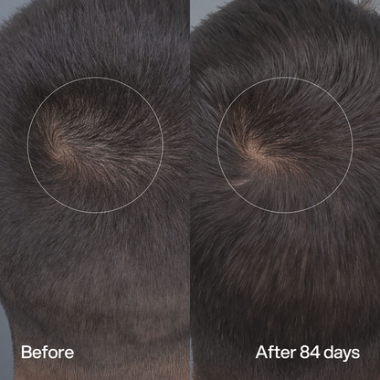 Hair Density Peptide Serum
