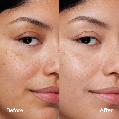 BB Cream Skin First, risultati prima e dopo 1
