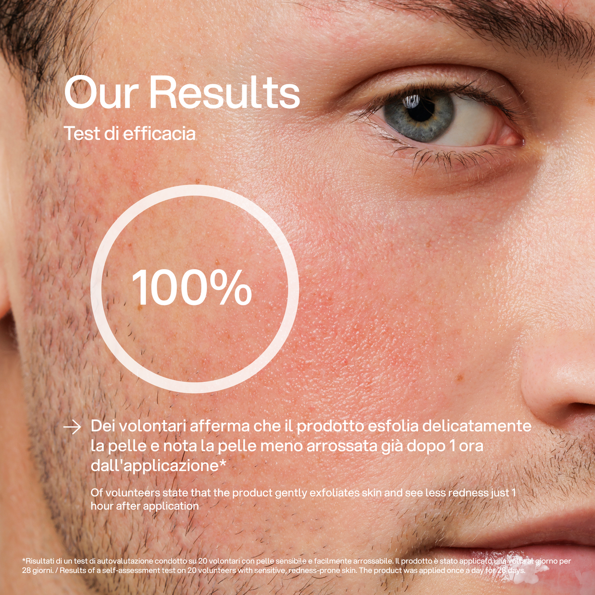 Esfoliante Pelli Sensibili Skin First, test di efficacia 1