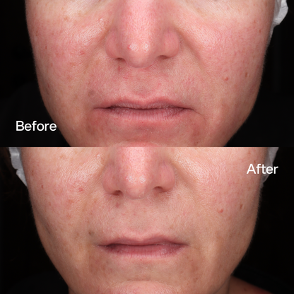 Booster Lenitivo Skin First, risultati prima e dopo 1