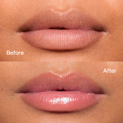 Peptide Lip Balm Pink Sugar Skin First, risultati prima e dopo 1