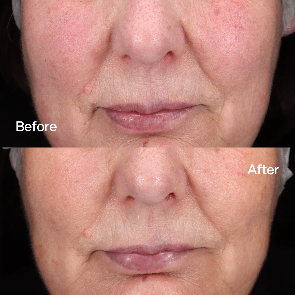 Booster Lenitivo Skin First, risultati prima e dopo 2
