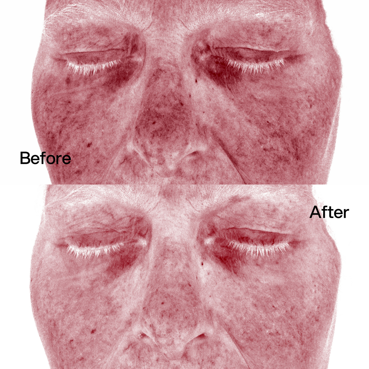 Crema Viso Cica Barrier Skin First, risultati prima e dopo