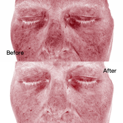 Crema Viso Cica Barrier Skin First, risultati prima e dopo