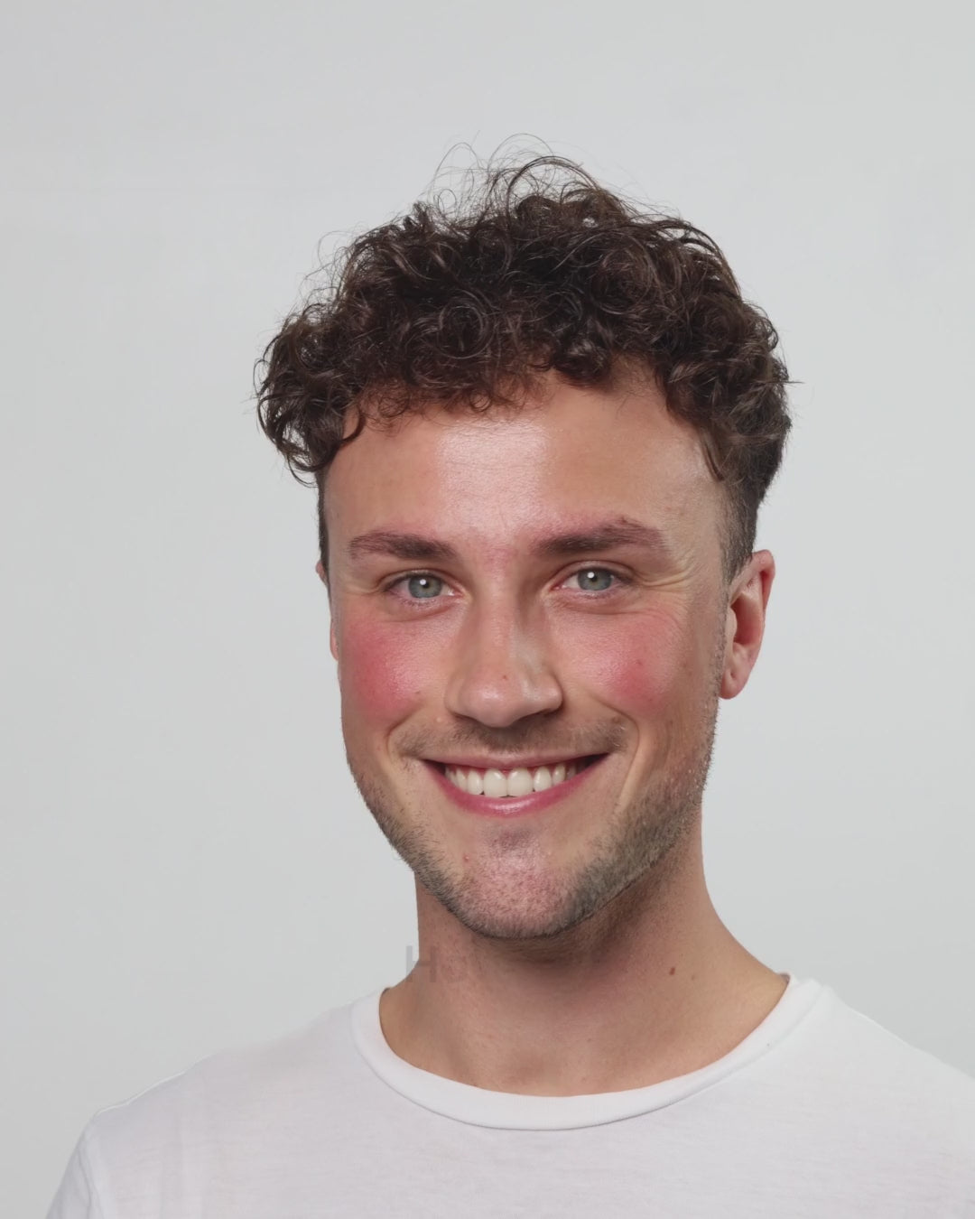 Carica il video: _protocollo-skincare-pelle-sensibile-rossori